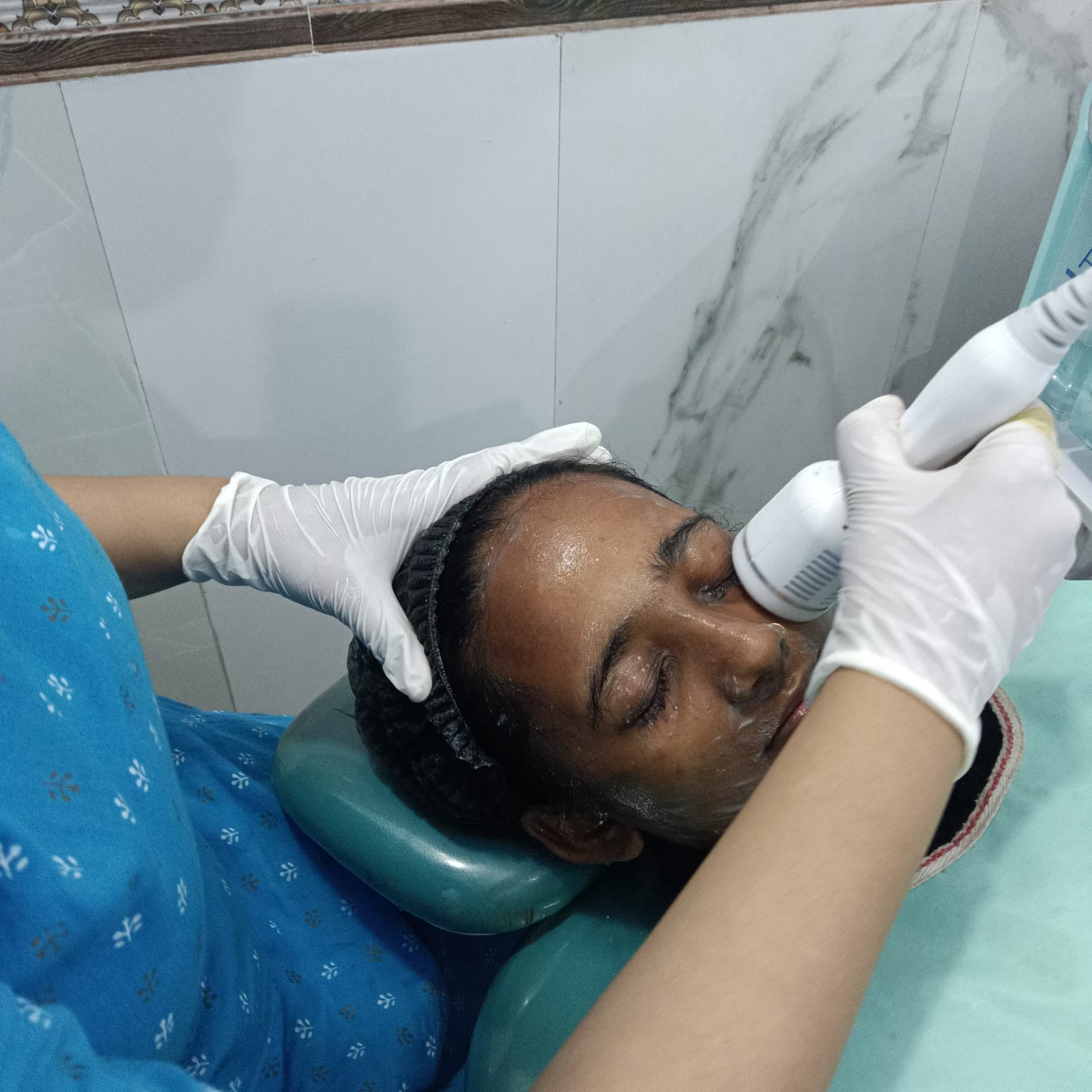 Patient undergoing a HydraFacial or similar cosmetic procedure